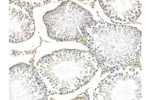 ABIN6258292 and ABIN6276010 at 1/100 staining Rat testis tissue by IHC-P.