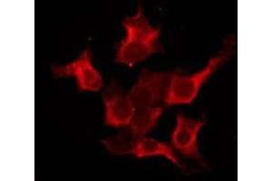 ABIN6276207 staining Hela by IF/ICC. (PRLHR antibody  (Internal Region))