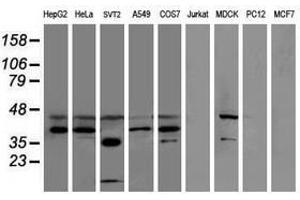 Image no. 2 for anti-Sulfotransferase Family, Cytosolic, 1C, Member 2 (SULT1C2) antibody (ABIN1501234) (SULT1C2 antibody)