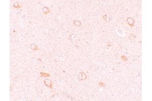 Immunohistochemical staining of human brain cells with CIITA polyclonal antibody  at 10 ug/mL. (CIITA antibody  (N-Term))