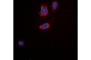Immunofluorescent analysis of Tachykinin Receptor 3 staining in A549 cells. (TACR3 antibody  (C-Term))