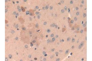 IHC-P analysis of Mouse Cerebrum Tissue, with DAB staining. (Cathepsin L antibody  (AA 18-113))