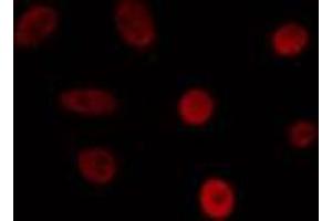 ABIN6274468 staining 293 cells by IF/ICC. (ISL2 antibody  (Internal Region))