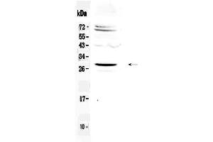 Western blot analysis of SIX6 using anti-SIX6 antibody . (SIX Homeobox 6 antibody  (AA 188-246))