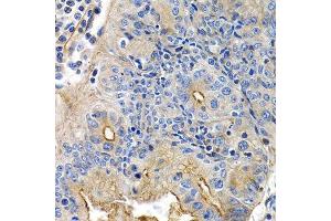 Immunohistochemistry (Paraffin-embedded Sections) (IHC (p)) image for anti-Prostacyclin Receptor (PTGIR) (AA 207-386) antibody (ABIN3015619)