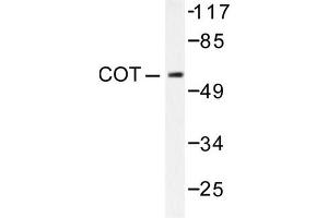 Image no. 1 for anti-Mitogen-Activated Protein Kinase Kinase Kinase 8 (MAP3K8) antibody (ABIN265369) (MAP3K8 antibody)