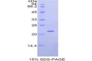 SDS-PAGE analysis of Human MMP12 Protein.