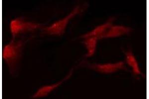 ABIN6274306 staining LOVO by IF/ICC. (Retinol Binding Protein 5 antibody)