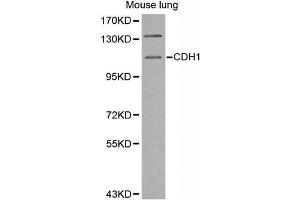 Western Blotting (WB) image for anti-Cadherin 1, Type 1, E-Cadherin (Epithelial) (CDH1) antibody (ABIN6220010) (E-cadherin antibody)