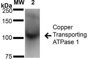 Western Blot analysis of Rat Brain Membrane showing detection of ~180 kDa Copper Transporting ATPase 1 protein using Mouse Anti-Copper Transporting ATPase 1 Monoclonal Antibody, Clone S60-4 .