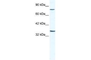 WB Suggested Anti-ZNF337 Antibody Titration:  2. (ZNF337 antibody  (Middle Region))