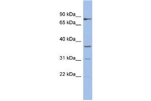 WB Suggested Anti-OLAH Antibody Titration: 0. (OLAH antibody  (N-Term))