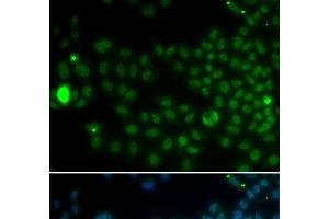 Immunofluorescence analysis of MCF-7 cells using SPDYA Polyclonal Antibody (SPDYA antibody)