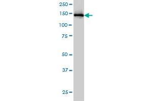 IKBKAP monoclonal antibody (M03), clone 6G9 Western Blot analysis of IKBKAP expression in HeLa . (IKAP/p150 antibody  (AA 1242-1331))