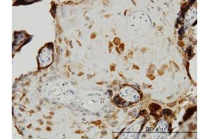 Immunoperoxidase of monoclonal antibody to TIMP2 on formalin-fixed paraffin-embedded human placenta. (TIMP2 antibody  (AA 27-220))
