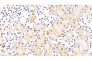 Detection of NUP88 in Mouse Kidney Tissue using Polyclonal Antibody to Nucleoporin 88 (NUP88)