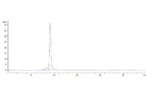 The purity of Anti-SOST / Sclerostin Reference Antibody (setrusumab) is 91. (Recombinant SOST (Setrusumab Biosimilar) antibody)