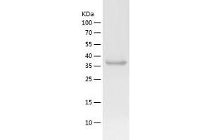 Western Blotting (WB) image for Aldolase C, Fructose-Bisphosphate (ALDOC) (AA 1-363) protein (His tag) (ABIN7121790) (ALDOC Protein (AA 1-363) (His tag))