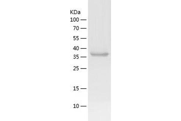 ALDOC Protein (AA 1-363) (His tag)