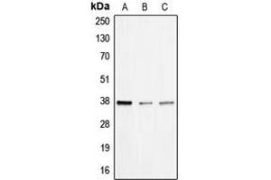 Western blot analysis of BNIP2 expression in HEK293T (A), mouse liver (B), rat liver (C) whole cell lysates. (BNIP2 antibody  (Center))