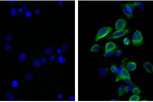 Human pancreatic carcinoma cell line MIA PaCa-2 was stained with Mouse Anti-Cytokeratin 18-UNLB and DAPI. (Rat anti-Mouse IgG2b Antibody (FITC))
