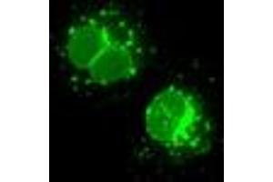 Anti-LEMD3 mouse monoclonal antibody (ABIN2453230) immunofluorescent staining of COS7 cells transiently transfected by pCMV6-ENTRY LEMD3 (RC212759). (LEMD3 antibody)