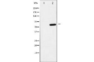Western blot analysis of p62 Dok phosphorylation expression in K562 whole cell lysates,The lane on the left is treated with the antigen-specific peptide. (DOK1 antibody  (pTyr398))
