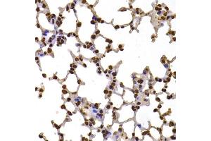 Immunohistochemistry of paraffin-embedded mouse lung using FBXW7 antibody (ABIN5975397) at dilution of 1/100 (40x lens).