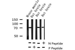 Western Blotting (WB) image for anti-Ribosomal Protein S6 Kinase, 70kDa, Polypeptide 1 (RPS6KB1) (pSer424) antibody (ABIN6256333)