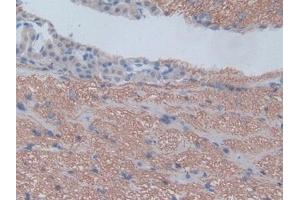 IHC-P analysis of Rat Cerebrum Tissue, with DAB staining. (CXCL1 antibody  (AA 25-96))