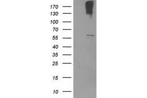 Western Blotting (WB) image for anti-Cytochrome P450, Family 2, Subfamily J, Polypeptide 2 (CYP2J2) antibody (ABIN1497734)