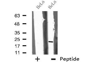 Western blot analysis of extracts from HeLa cells, using CHP antibody. (CHP antibody  (Internal Region))