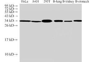 Western Blot analysis of 1)Hela, 2)A431, 3)293T, 4)Bovine lung, 5)Bovine kidney, 6)Bovine stomach using ANXA5 Polyclonal Antibody at dilution of 1:500 (Annexin V antibody)
