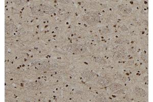 ABIN6255514 and ABIN6267208 at 1/100 staining Rat brain tissue by IHC-P.