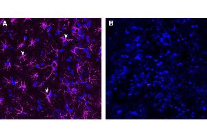 Expression of GFAP in rat hippocampus. (GFAP antibody  (Intracellular) (Atto 647N))
