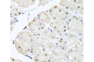 Immunohistochemistry of paraffin-embedded Human stomach using DNAL1 Polyclonal Antibody at dilution of 1:100 (40x lens). (DNAL1 antibody)