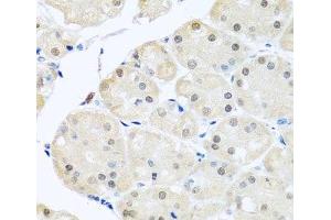 Immunohistochemistry of paraffin-embedded Human stomach using DNAL1 Polyclonal Antibody at dilution of 1:100 (40x lens).