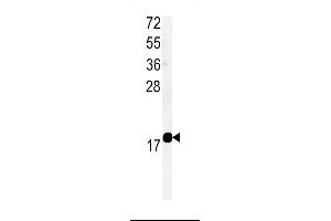 Western blot analysis of T Antibody (Center) (ABIN651323 and ABIN2840187) in mouse bladder tissue lysates (35 μg/lane). (TMEM222 antibody  (AA 107-135))