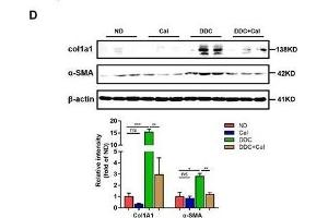 Calcipotriol alleviates DDC-induced liver injury and fibrosis. (COL1A1 antibody  (AA 100-200))