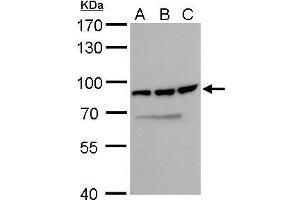 WB Image DDX18 antibody detects DDX18 protein by Western blot analysis. (DDX18 antibody  (Center))