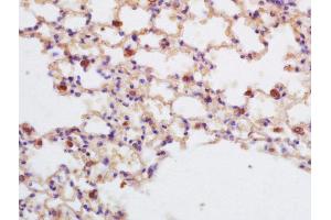 Formalin-fixed and paraffin embedded mouse lung labeled with Rabbit Anti-ASPP2/p53BP2 Polyclonal Antibody, Unconjugated (ABIN674394) at 1:200 followed by conjugation to the secondary antibody and DAB staining (TP53BP2 antibody  (AA 1001-1128))