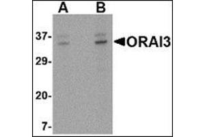 Western blot analysis of ORAI3 in A20 cell lysate with this product at (A) 2 and (B) 4 μg/ml. (ORAI3 antibody  (C-Term))