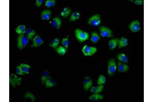 Immunofluorescence staining of Hela cells with ABIN7143386 at 1:166, counter-stained with DAPI. (ADGRE2 antibody  (AA 151-323))