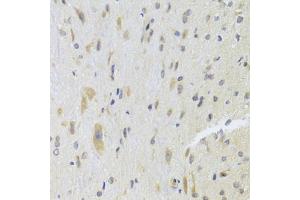Immunohistochemistry of paraffin-embedded rat spinal cord using DPP3 Antibody (ABIN5975468) at dilution of 1/100 (40x lens).