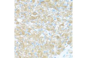 Immunohistochemistry (Paraffin-embedded Sections) (IHC (p)) image for anti-Fibroblast Growth Factor Receptor 2 (FGFR2) (AA 1-100) antibody (ABIN3022855)