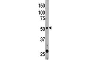The Beclin 1 antibody used in western blot to detect BECN1 in mouse liver tissue lysate