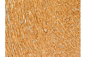 ABIN6264198 and ABIN6266655 at 1/100 staining Rat heart tissue by IHC-P.