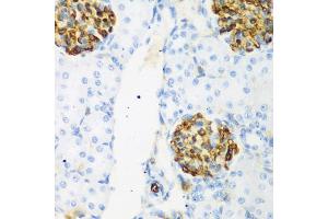 Immunohistochemistry of paraffin-embedded rat kidney using CSRNP1 antibody (ABIN5974288) at dilution of 1/200 (40x lens). (AXUD1 antibody)