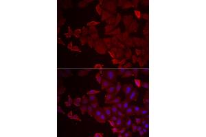 Immunofluorescence analysis of U2OS cells using MARCKSL1 antibody (ABIN5974290).