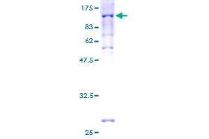 PEX5 Protein (AA 1-631) (GST tag)
